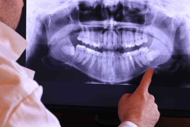 Best Emergency Wisdom Teeth Removal in Tutwiler, MS