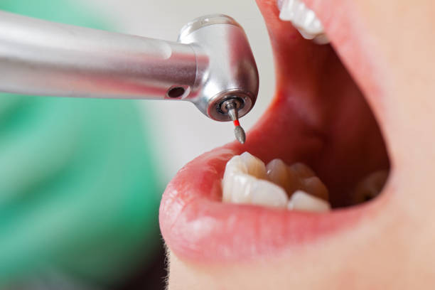 Best Same-Day Emergency Dental Services in Tutwiler, MS